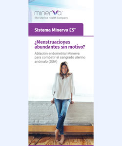 Minerva Patient Brochure –  Spanish