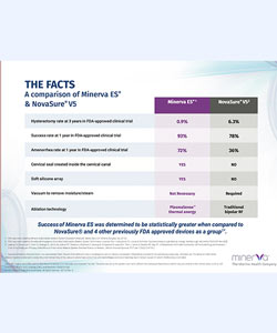 Minerva ES and NovaSure V5 Technology Comparison